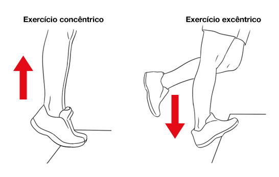 Reparação do tendão rompido através de cirurgia