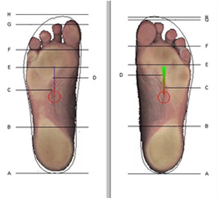 7. Scanner Ped Cad