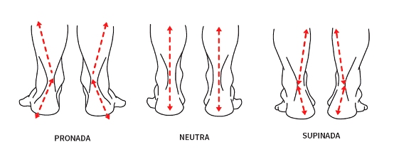 Tipos de pisada: pronada, neutra e supinada.