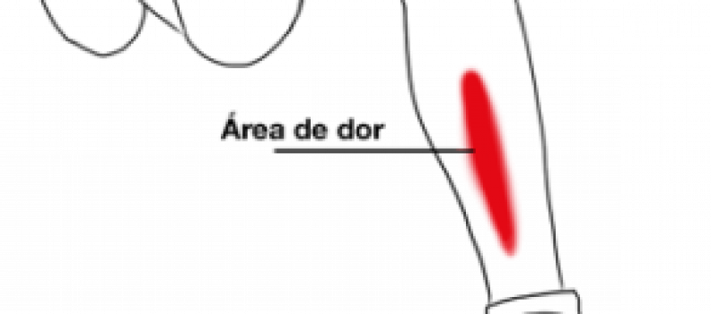 Canelite: causa e tratamento