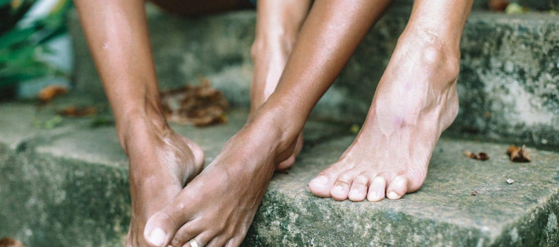 Dor no pé ao pisar: o que pode ser e como prevenir